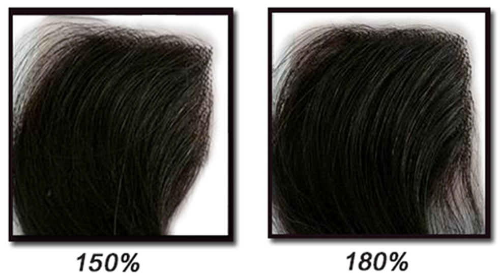 hair density