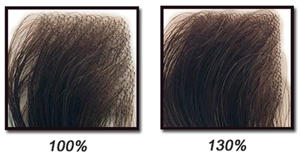 hair density
